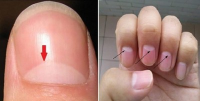 Half-Nail-1487329599.jpg