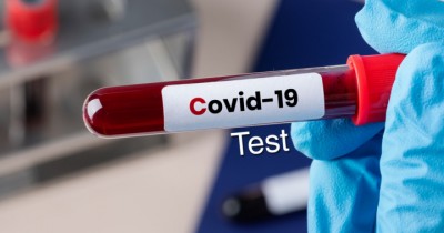 covide-1589606584.jpg