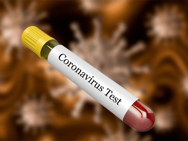 covide-test-1590144615.jpg
