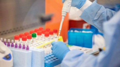 corona123-1596699878.jpg